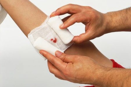 How to Stop Bleeding Minor Cuts, Scrapes, Bruises and Nosebleeds